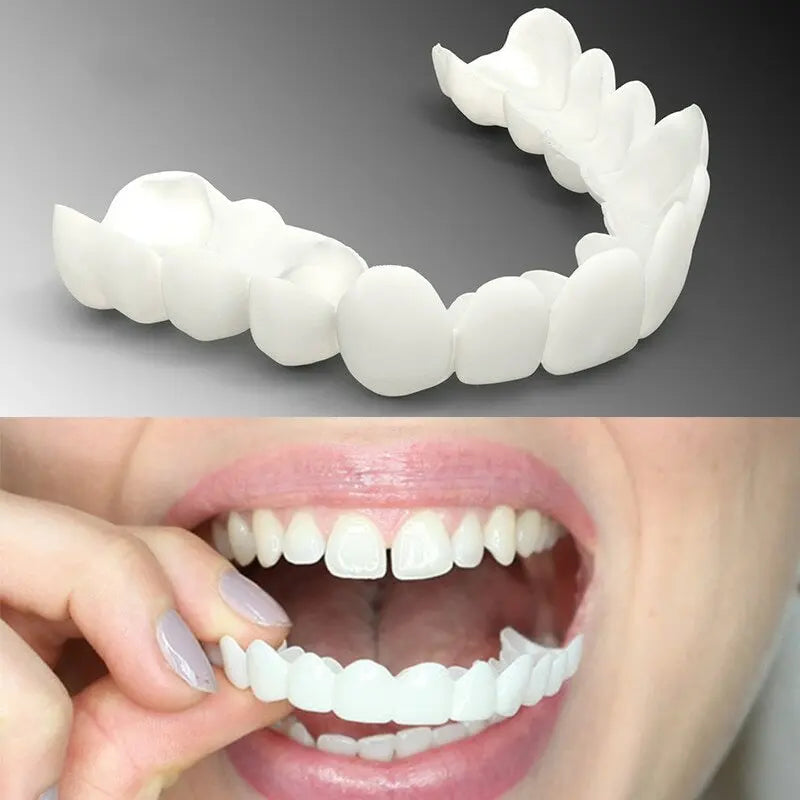 Brackets de silicona: carillas dentales removibles para una sonrisa perfecta 