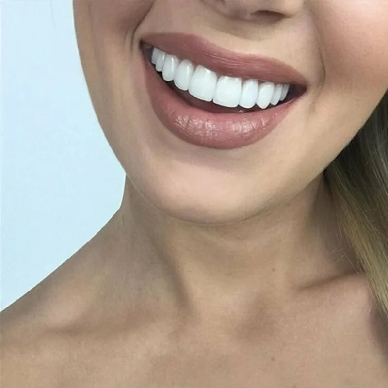 Brackets de silicona: carillas dentales removibles para una sonrisa perfecta 